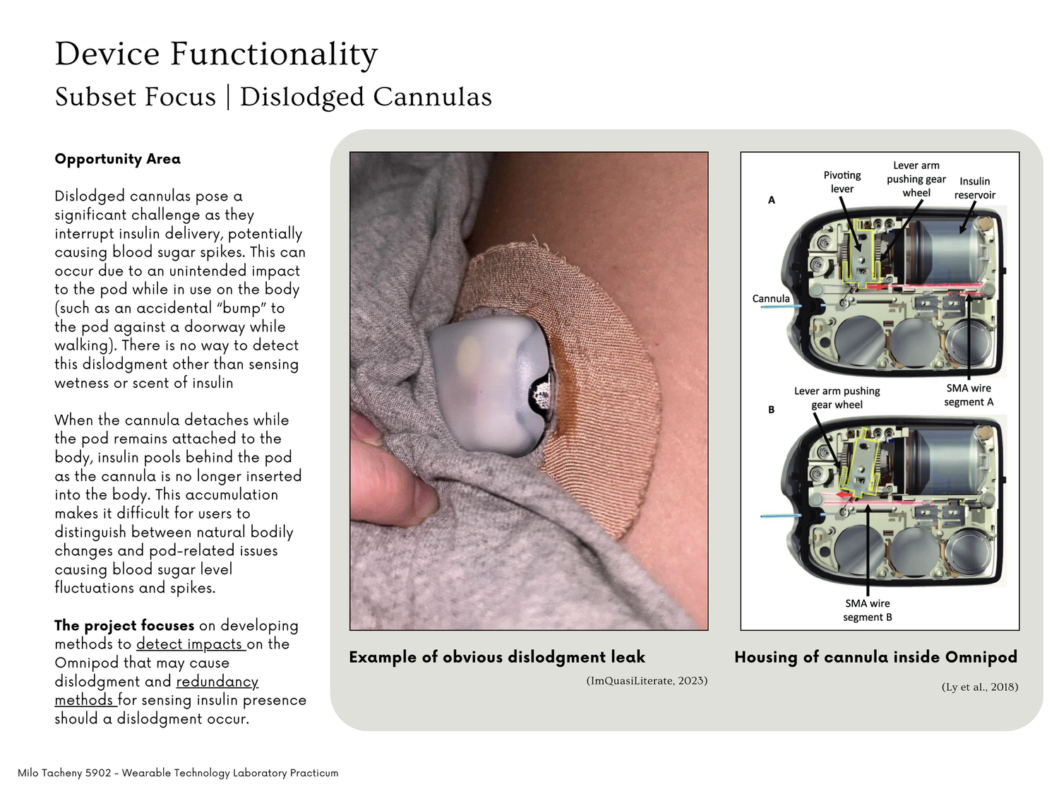 Enhancing Safety | Omnipod 5 — slide 4